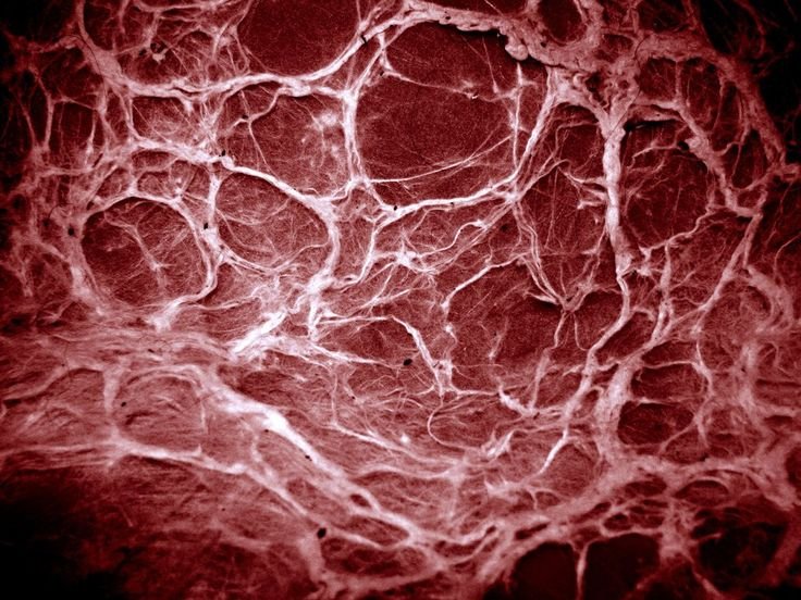 нодулярные