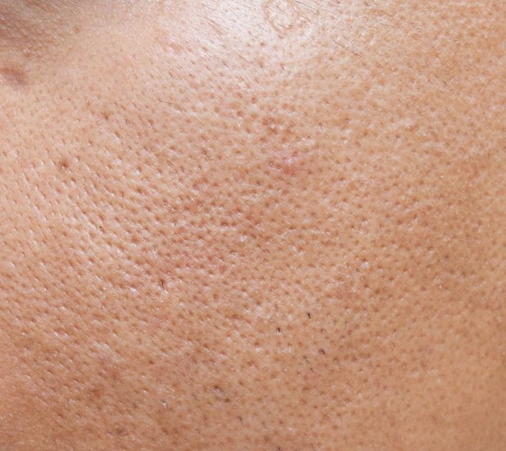 Текстура кожи лица
