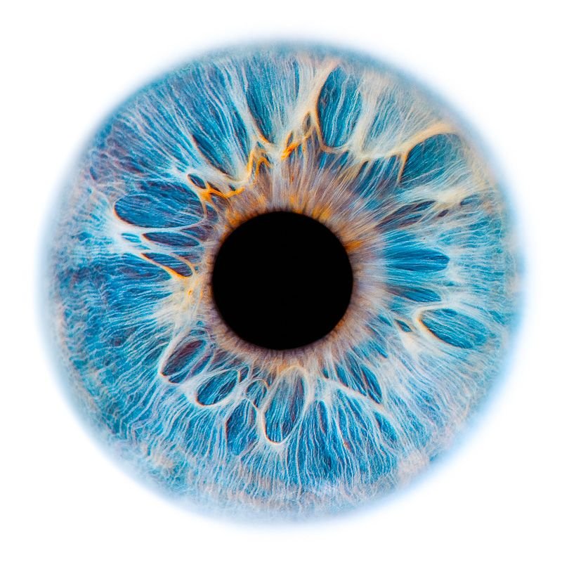 Субатрофичная радужка