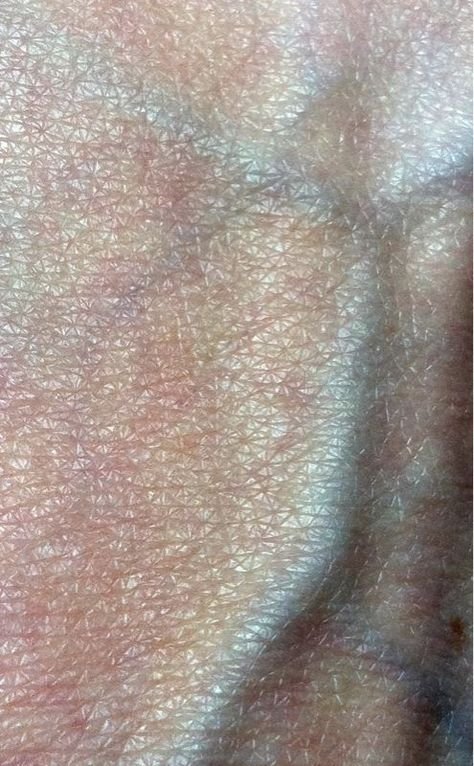 Human Skin texture