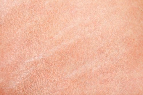 Фактура кожи человека