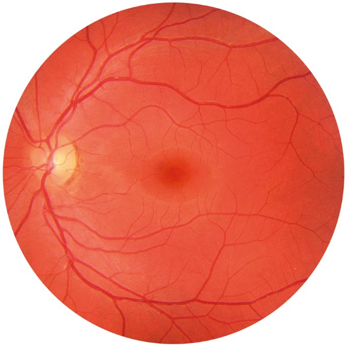 сетчатки глаза