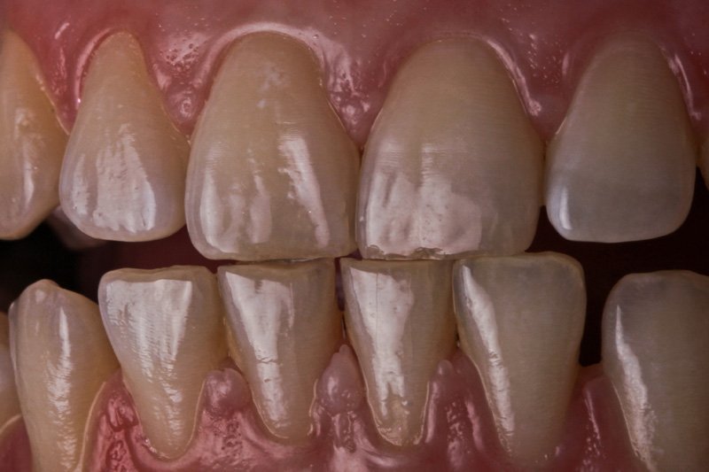 Текстура зубов бесшовная