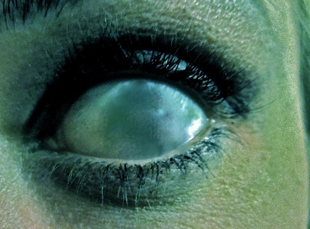 Зеленые глаза без зрачков