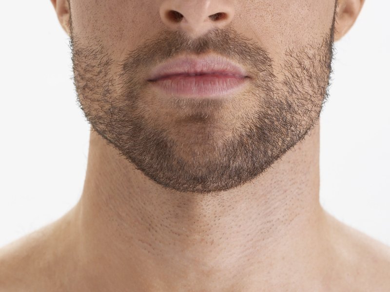 Щетина у мужчин