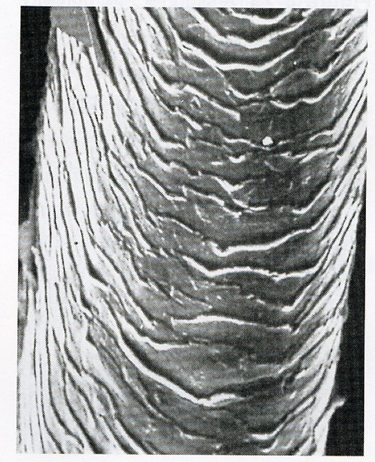 Пористость волос