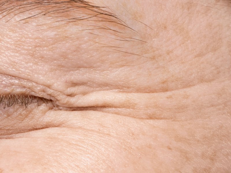 Текстура, поры – это нормально!