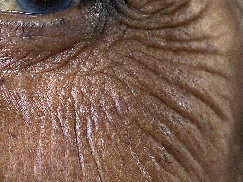 Морщины крупным планом