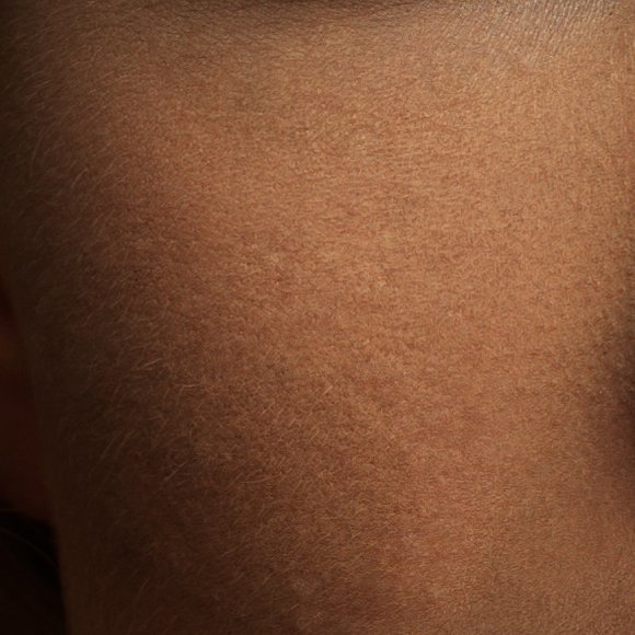 Фактура кожи лица для фотошопа