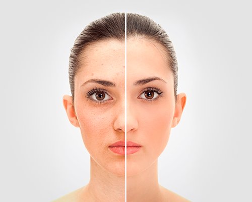 Неровный тон кожи