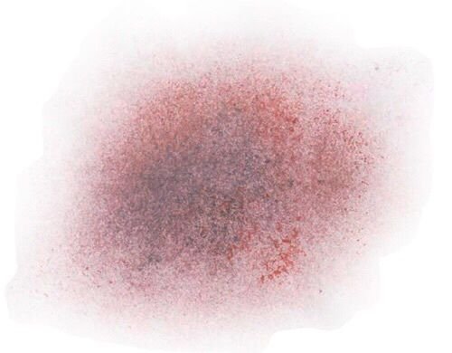 Кровоподтеки на прозрачном фоне