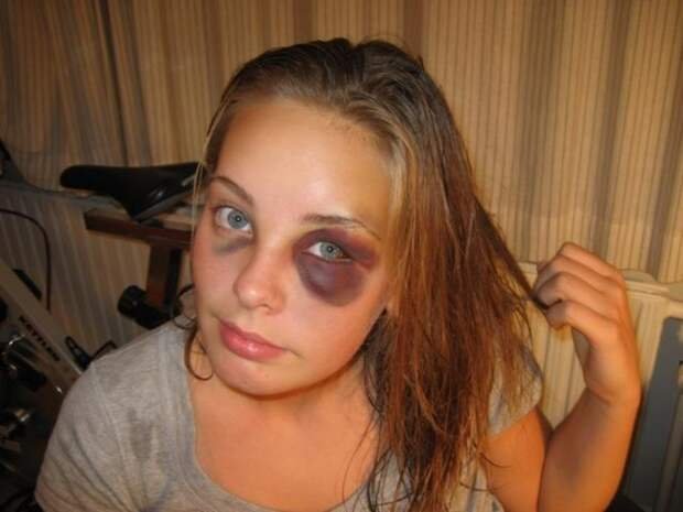 Фингал пр дглазом