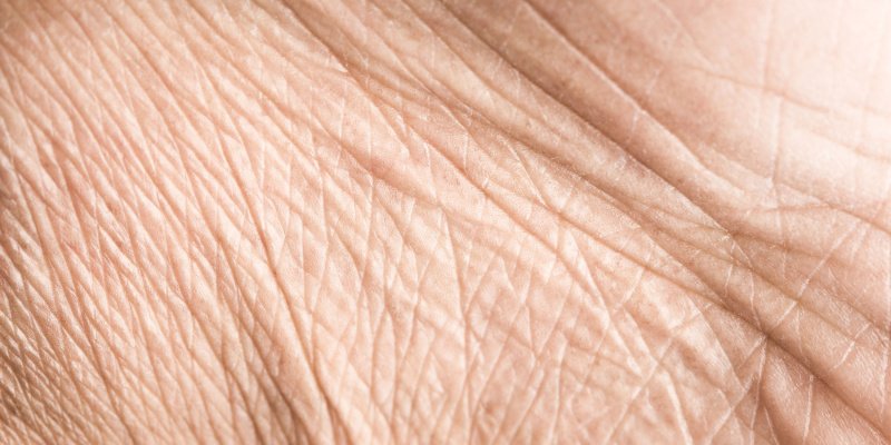 Морщины текстура