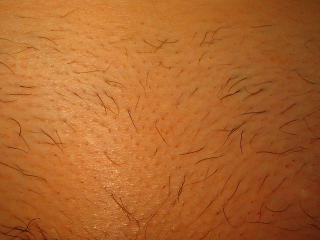 Лобковые волосы женские