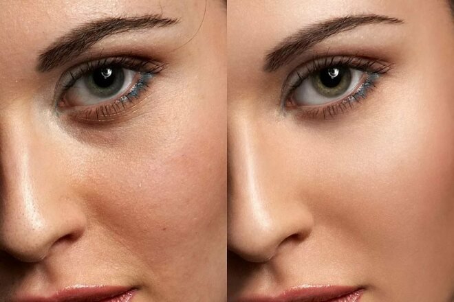 Профессиональная ретушь кожи