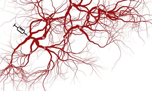 Сосуды без фона