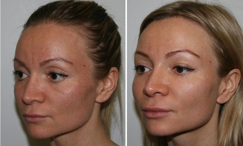 Малярные мешки