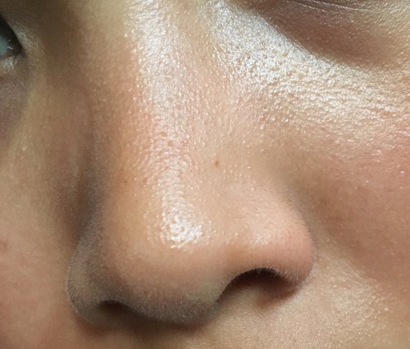 Текстура кожи лица