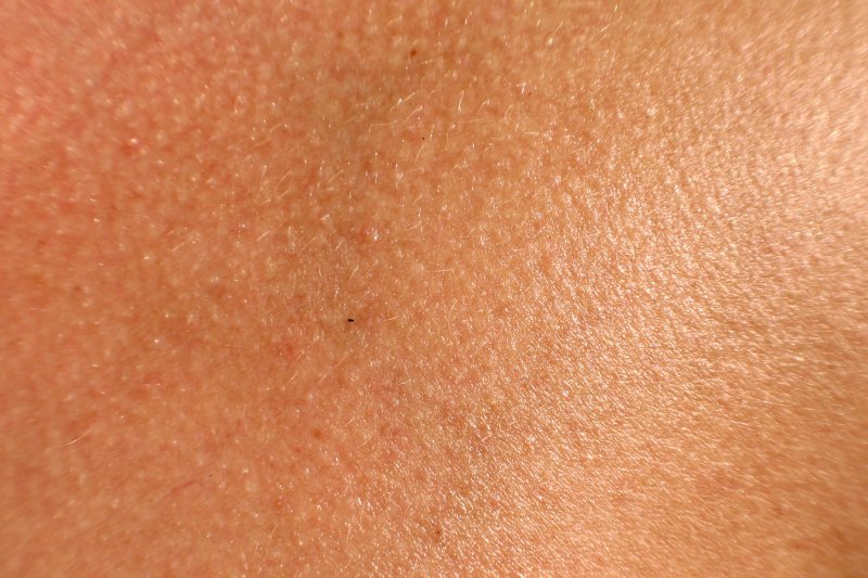 Кожа человека