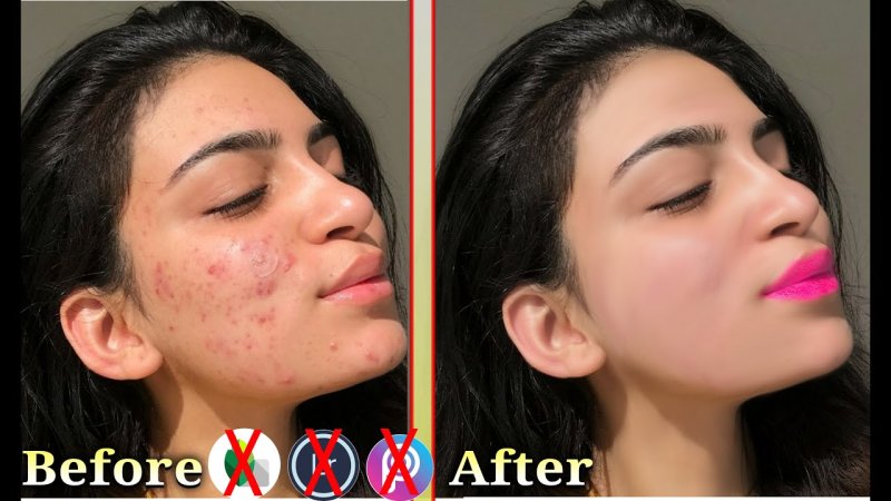 Кожа без эффекта сглаживания