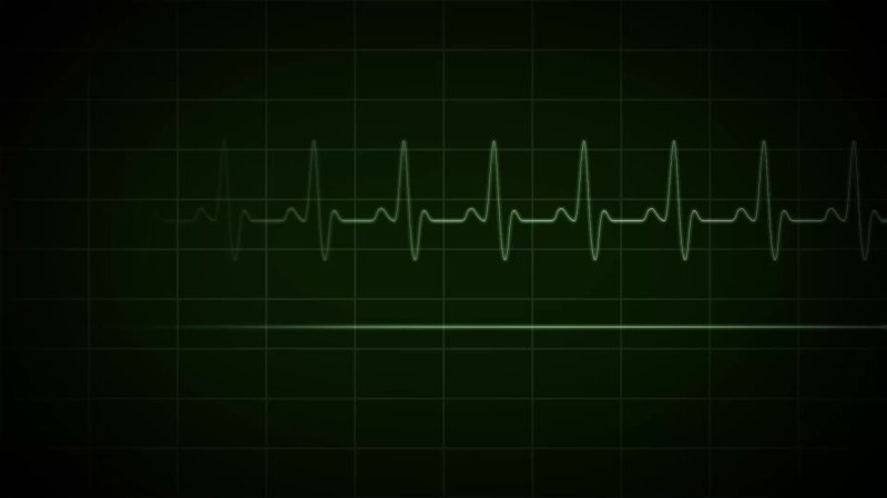 Кардиограмма фон
