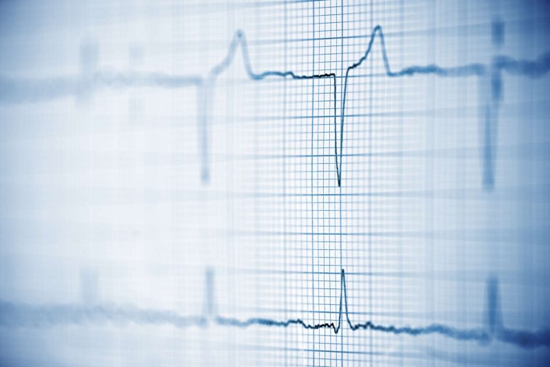 Фон для презентации кардиограмма