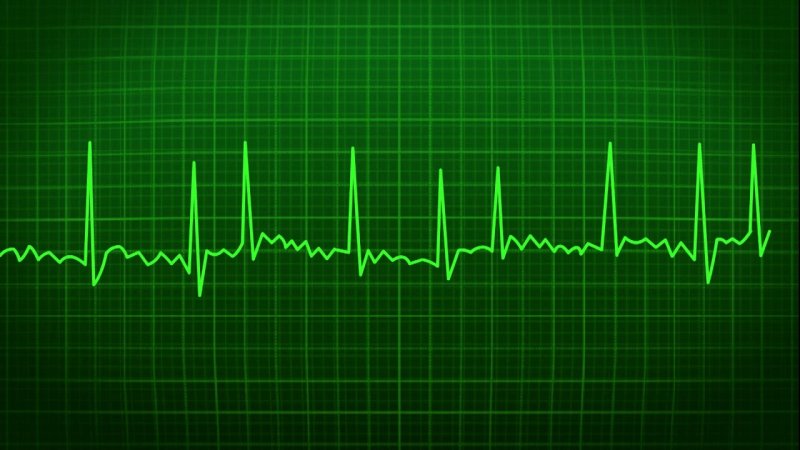 Кардиограмма сердца