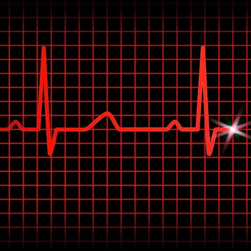Кардиограмма сердца