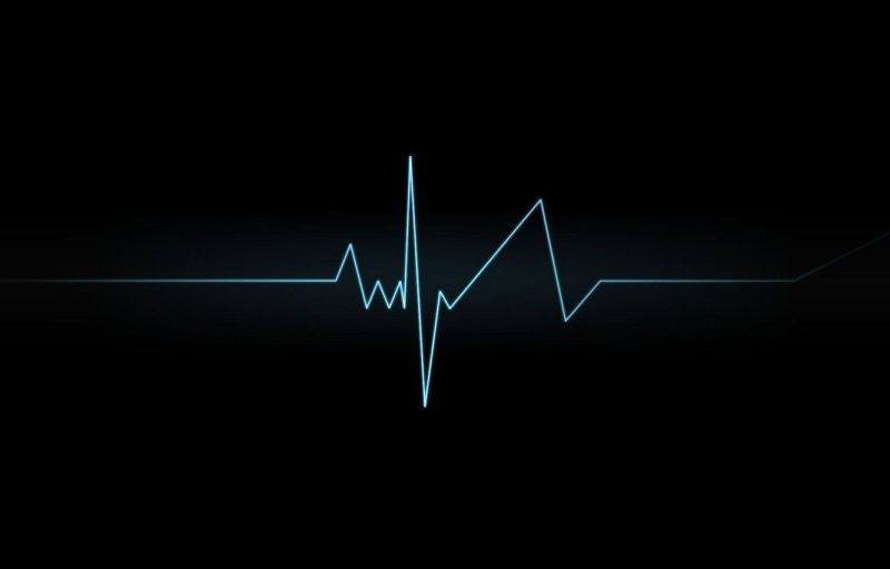 Кардиограмма