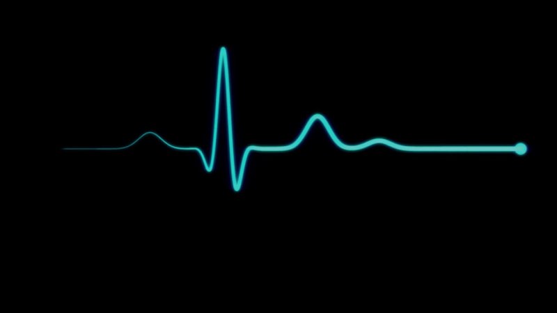 Кардиограмма