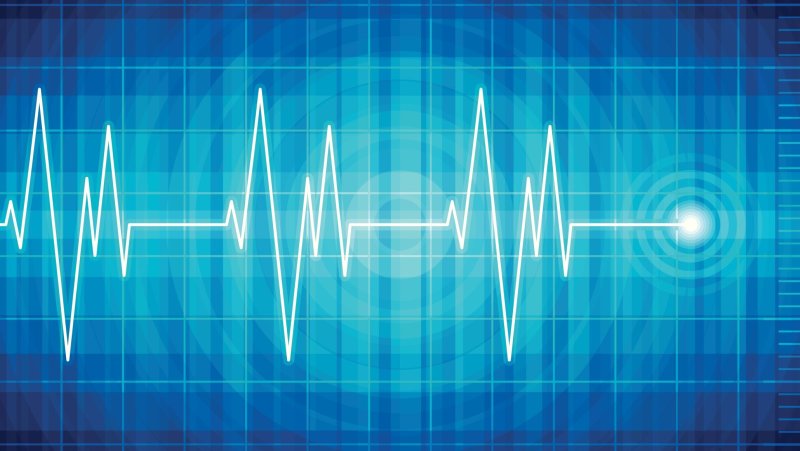 Кардиограмма фон