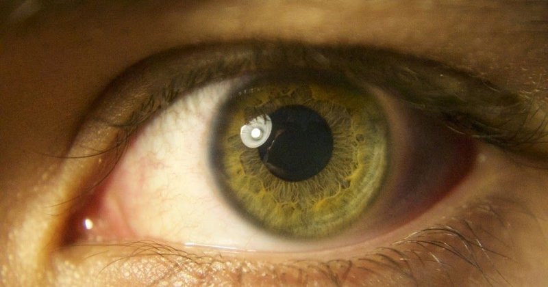 Желто зеленые глаза