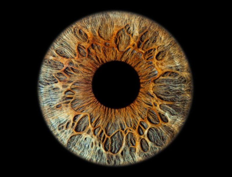 Радужная оболочка(радужка)-