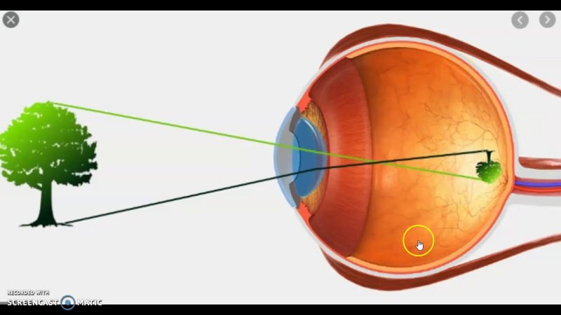 Изображение предмета на сетчатке глаза