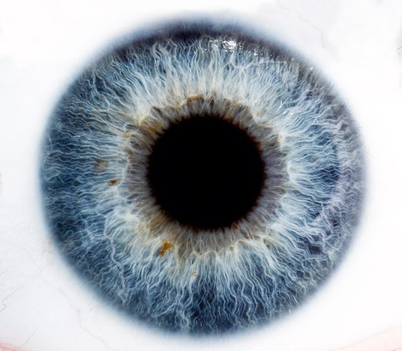 Радужная оболочка глаза