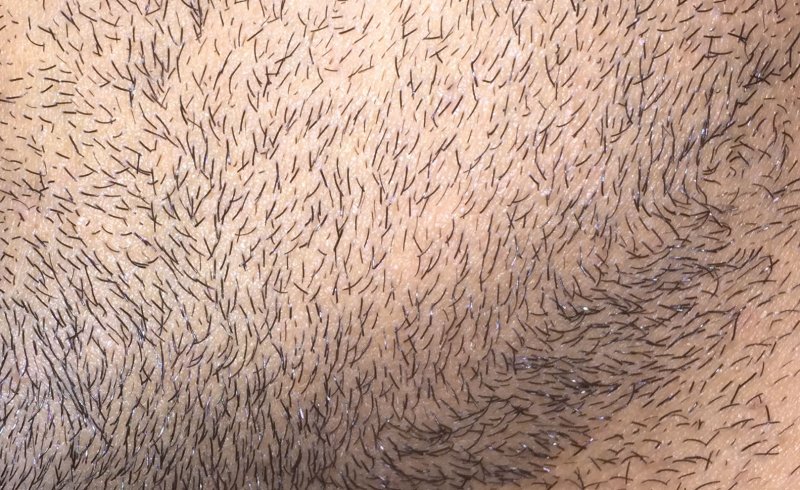 Фактура кожи человека