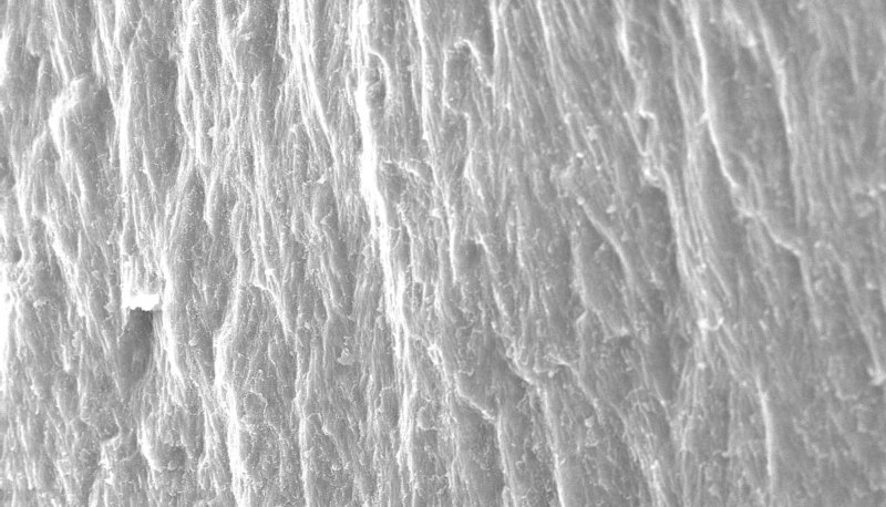 Эмаль зуба под микроскопом