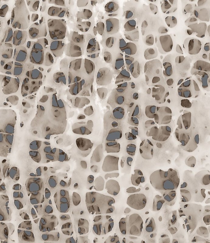 Текстура кости