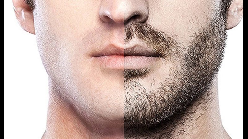 Мужская щетина