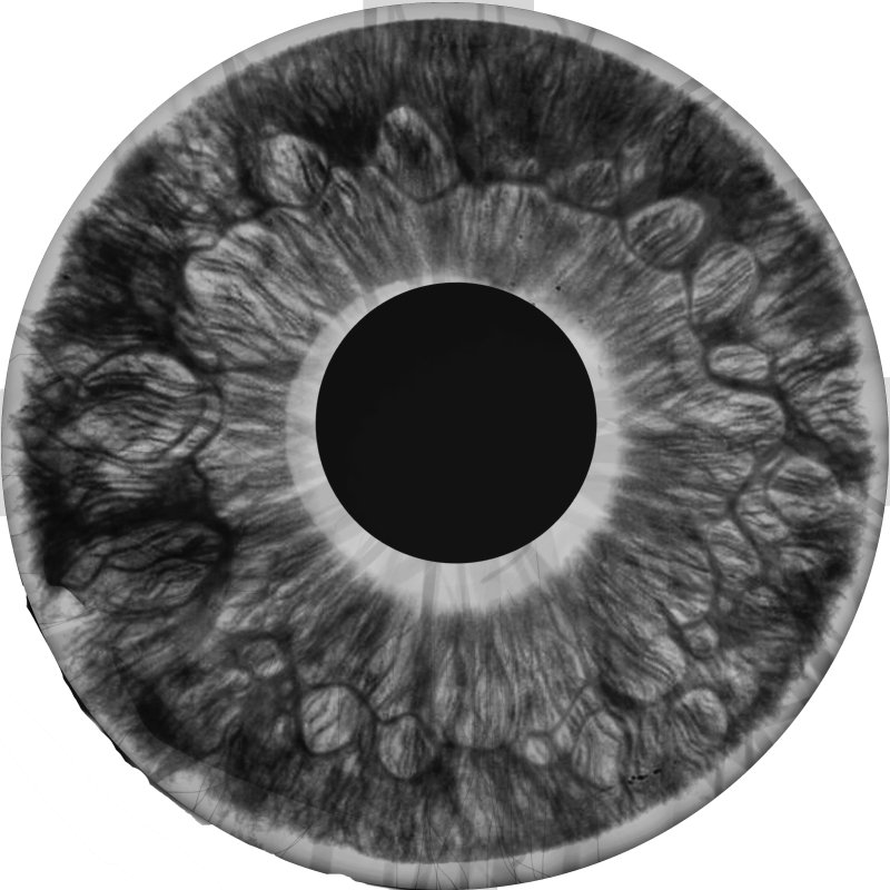 Белая радужка глаза