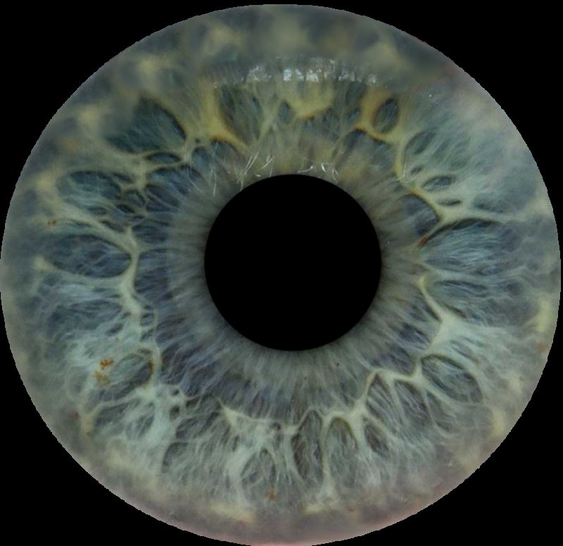 Радужка глаза сбоку