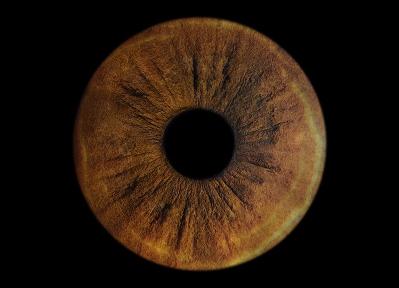 Радужная оболочка глаза