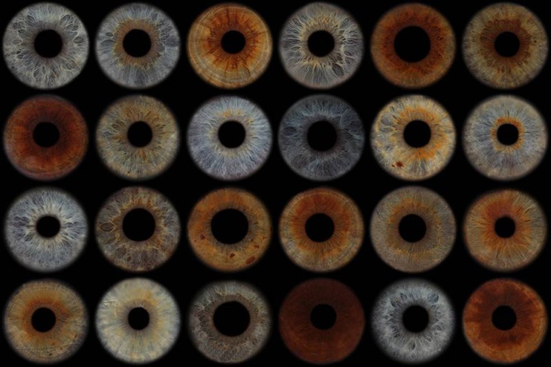 Коричневая радужка глаза