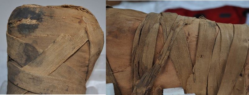 Льняные бинты