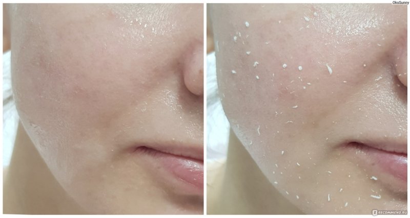 Фармстей пилинг скатка