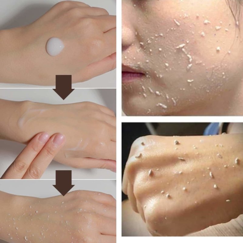 Кальция хлорид для лица пилинг