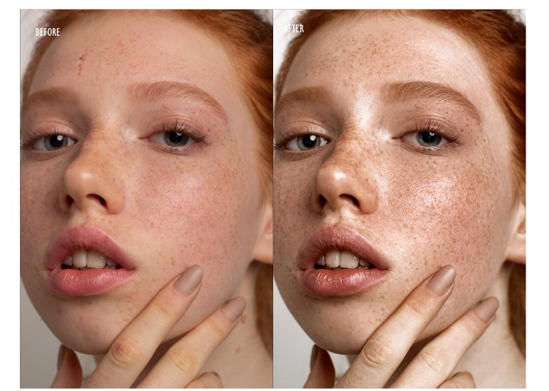 Неровный цвет лица