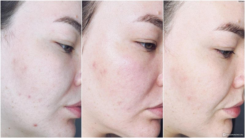 Тональный крем выравнивающий рельеф кожи