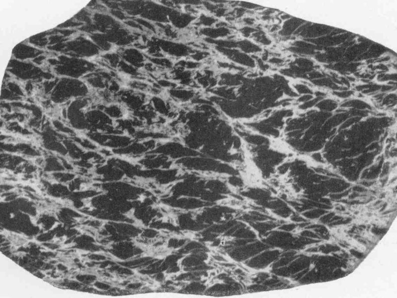 Брекчиевая и брекчиевидная текстура