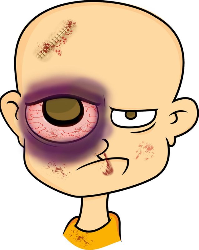 Мультяшка с синяками под глазами